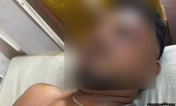 Kursi 11A: Kisah Ajaib Selamat dari Ledakan Air India, Ramesh!